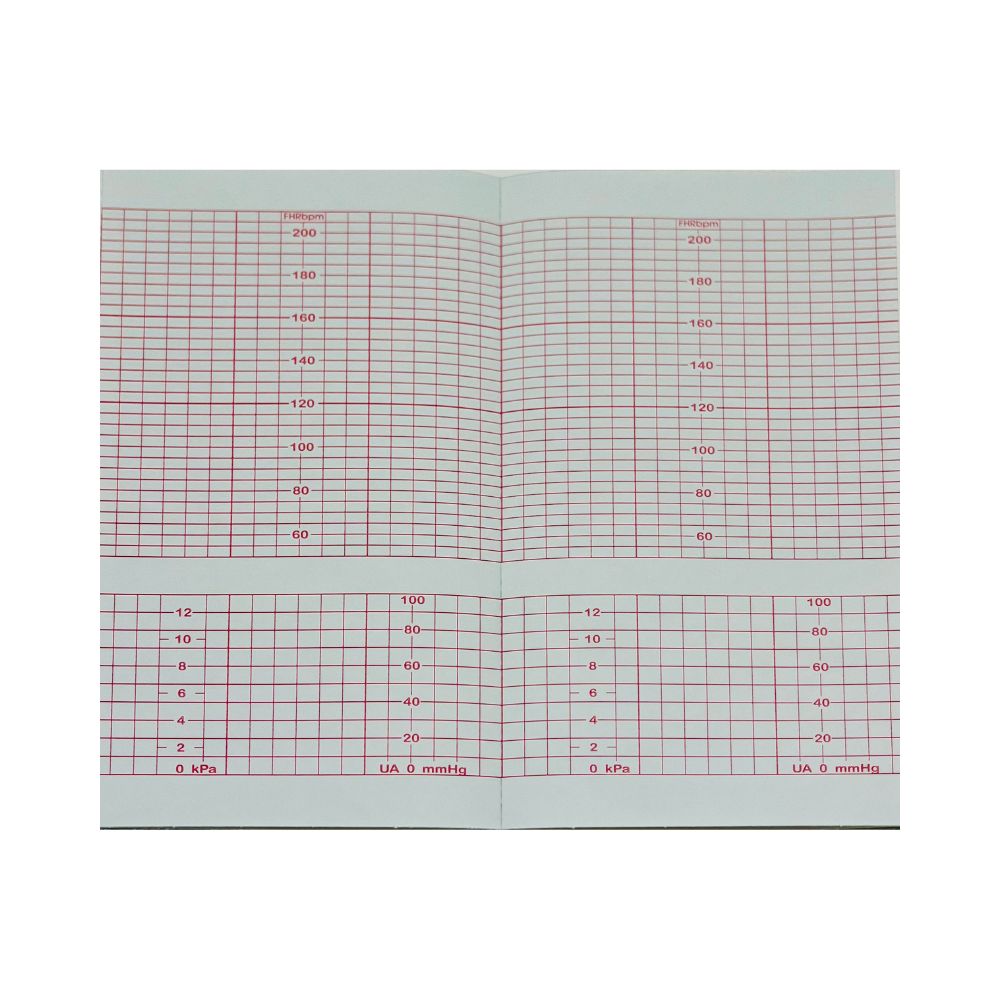 Papier KTG Corometrics BAO4305 EDAN F9 152x90x150 160 skala 210