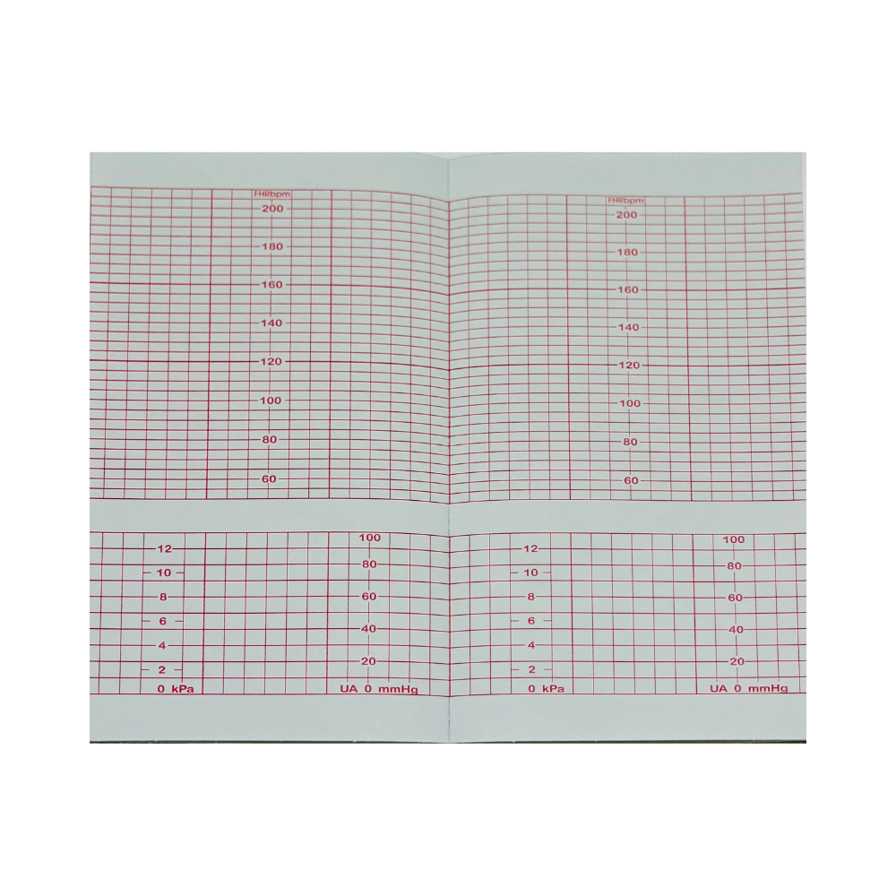 Papier KTG Corometrics BAO4305 EDAN F9 152x90x150 160 skala 210